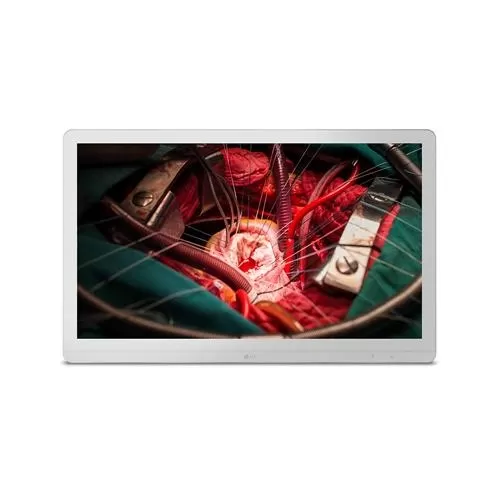 LG 27HJ710S-W 8MP Surgical Monitor price in Hyderabad, Telangana, Andhra pradesh